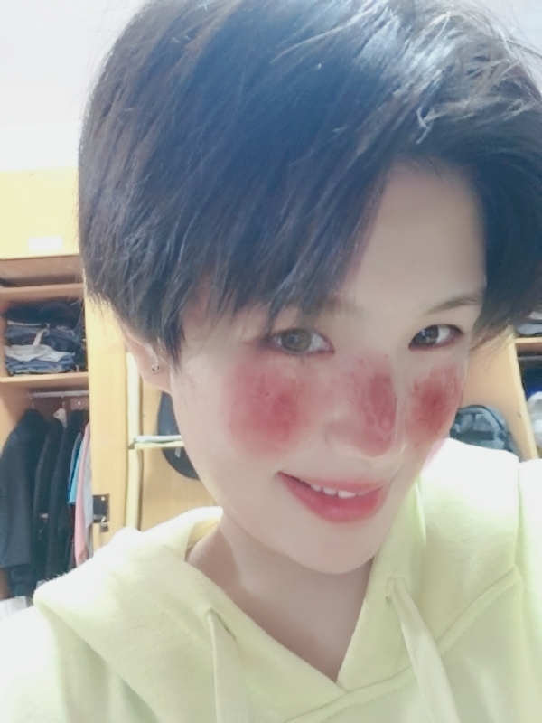 ⑤41的第一张照片--残疾人相亲网
